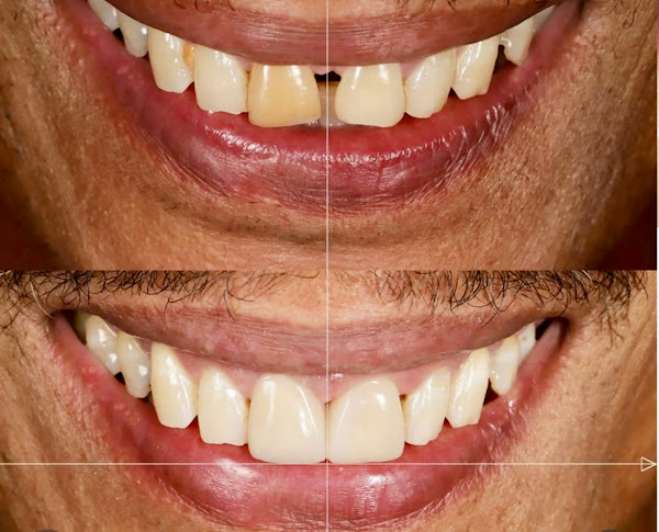 Resultado de Tratamento